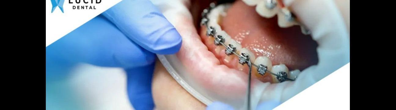 Lucid  Dental  Pune